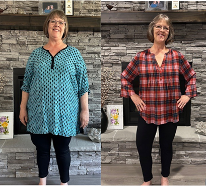 Shawn - Before & After