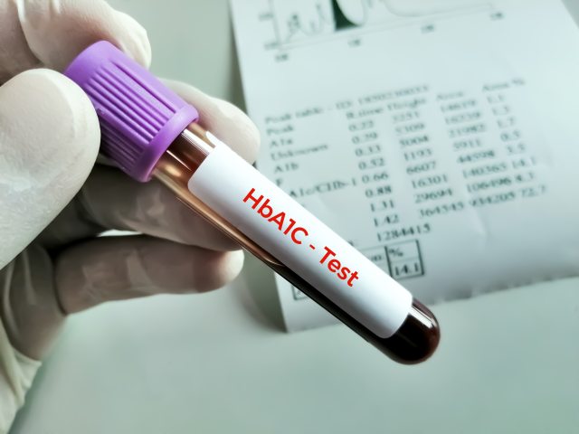 Close-up of gloved hand holding vial marked HbA1C-Test