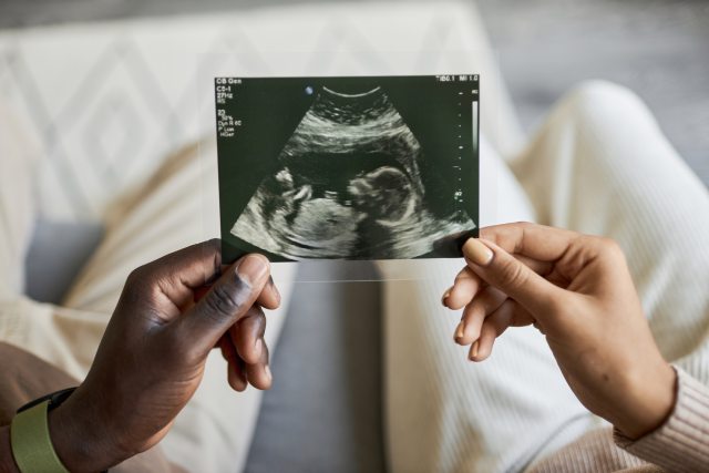 Closeup of ultrasound picture  