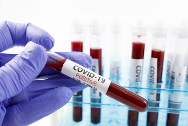 Close-up of lab workers gloved hand holding a filled glass test tube with the words "COVID-19 Positive" visible on the side