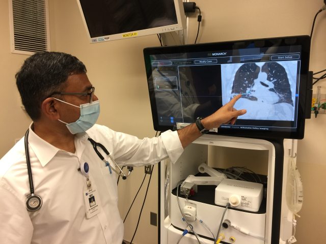 Dr. Karthik Mahadevan uses the Monarch Platform for lung cancer diagnosis at PeaceHealth Sacred Heart Medical Center at RiverBend