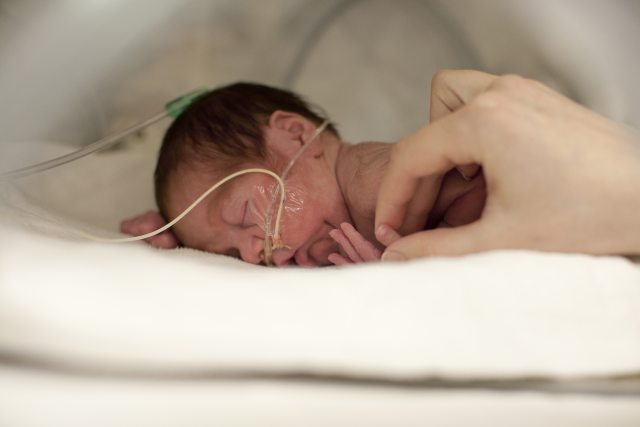A newborn baby with tubes attached to their face is treated by a health care worker